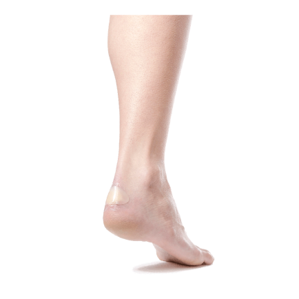 DoTobell Flaster za žuljeve 49P 3x